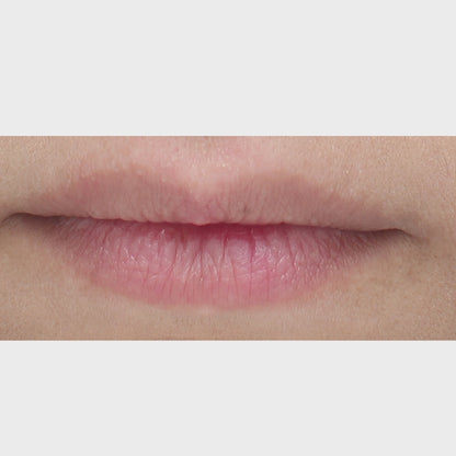 Lip Duo Results